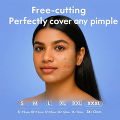Strong absorption with a moisture barrier supports clean healing.