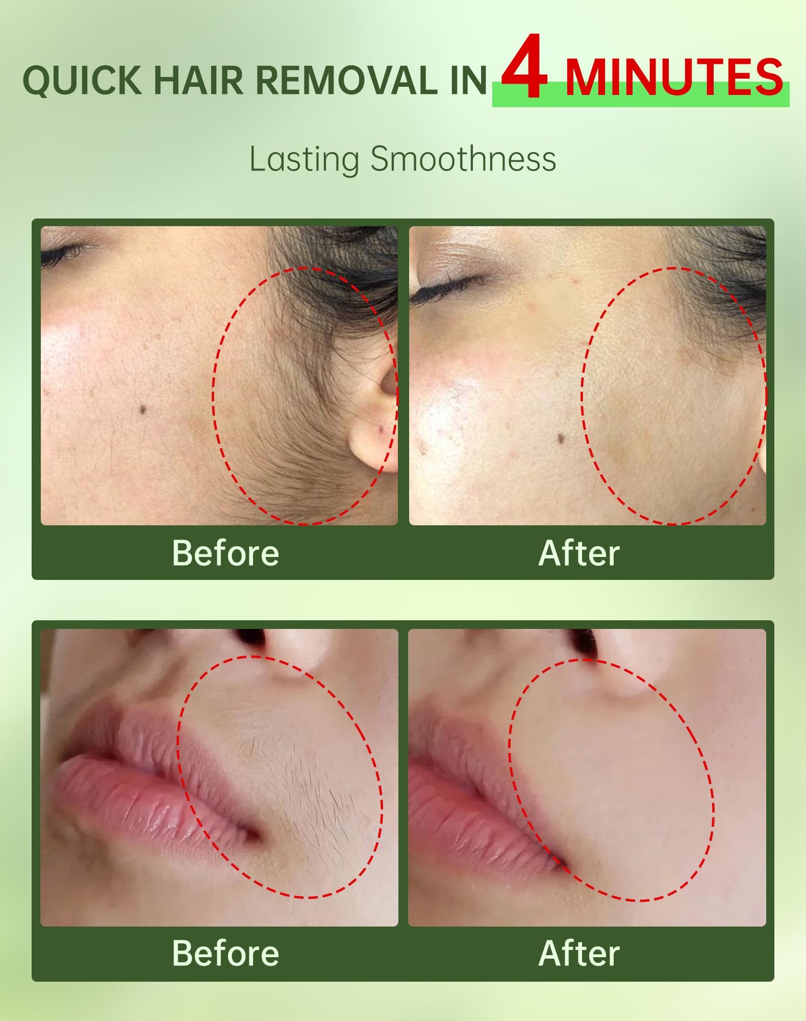 Zeponyx 2 in 1 kit with soothing cream for post removal calm