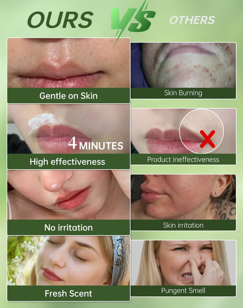 Zeponyx soothing ceramide NP panthenol cream post removal comfort