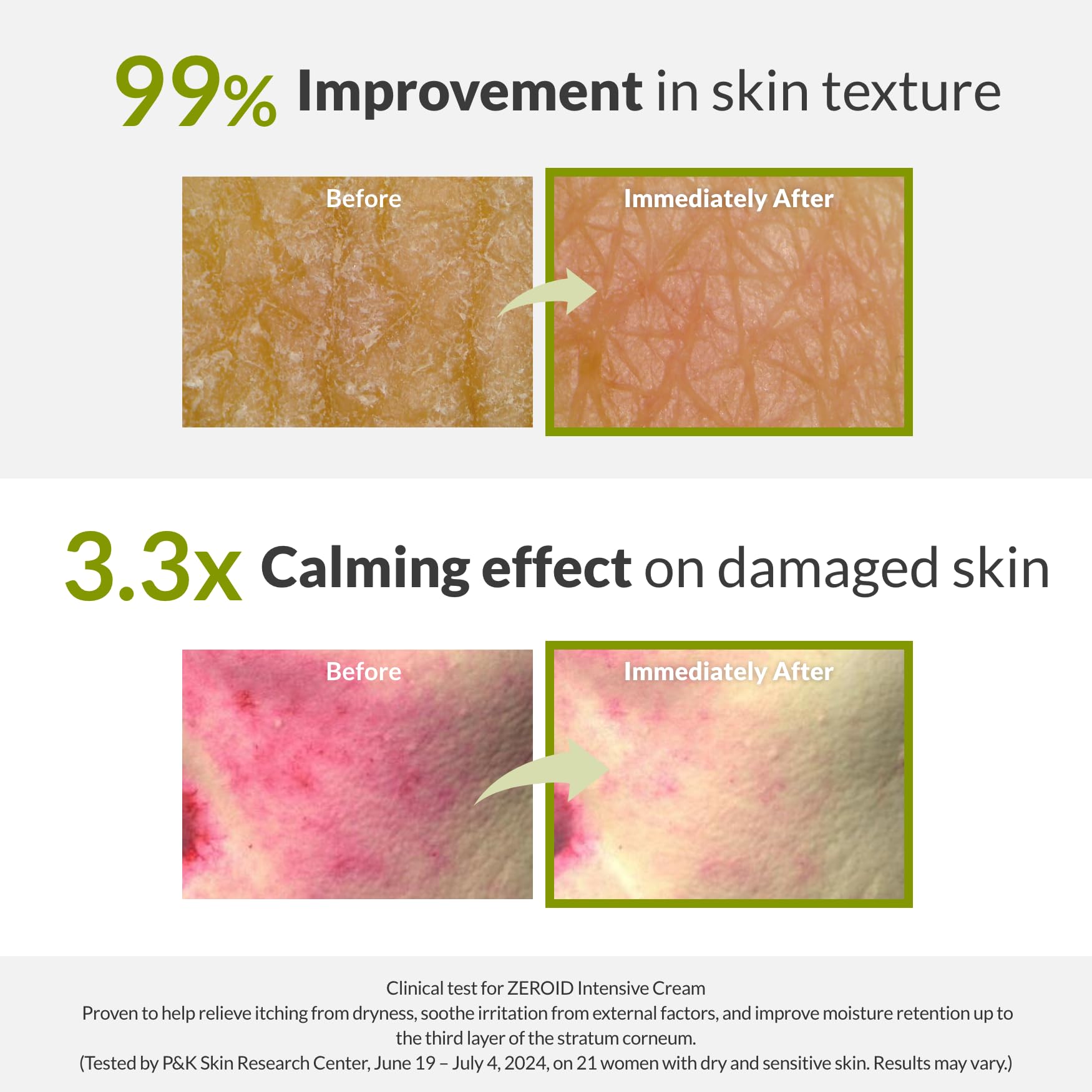 ZEROID bottle highlighting skin barrier improvement formula