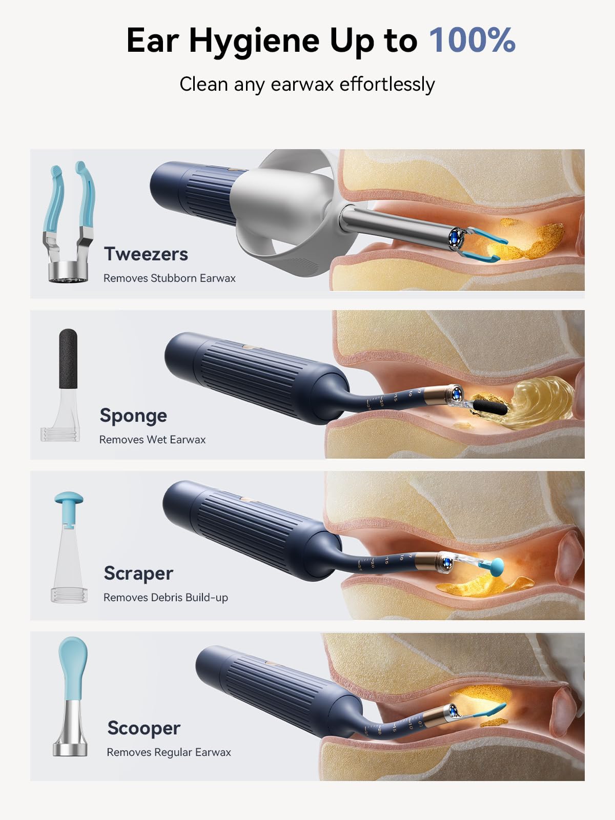 ZERONDER i35R home endoscope in use to monitor ear canal
