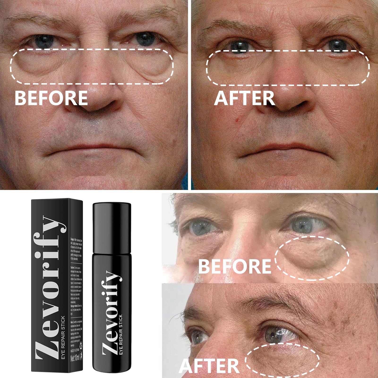 Zevorify Eye Repair Stick caffeine-infused formula hydrates delicate skin around the eyes.