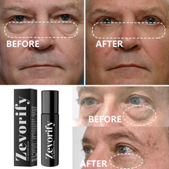 Zevorify Eye Repair Stick caffeine-infused formula hydrates delicate skin around the eyes.