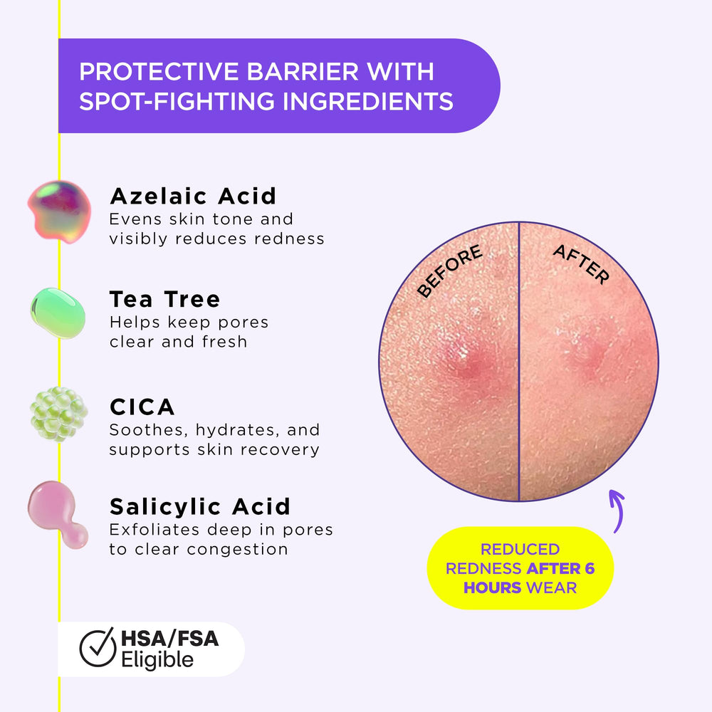 ZitSticka patch on the face under makeup for discrete protection.