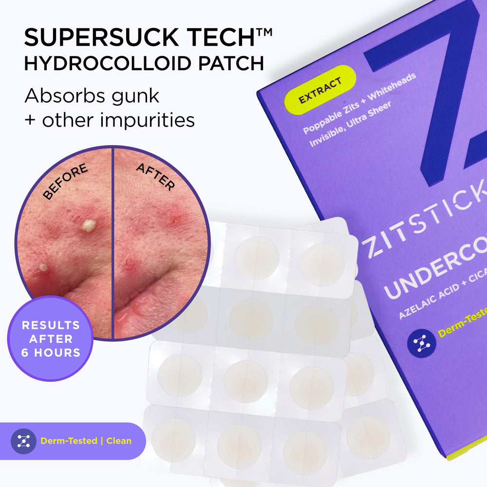 ZitSticka no-touch application system for hygienic use.