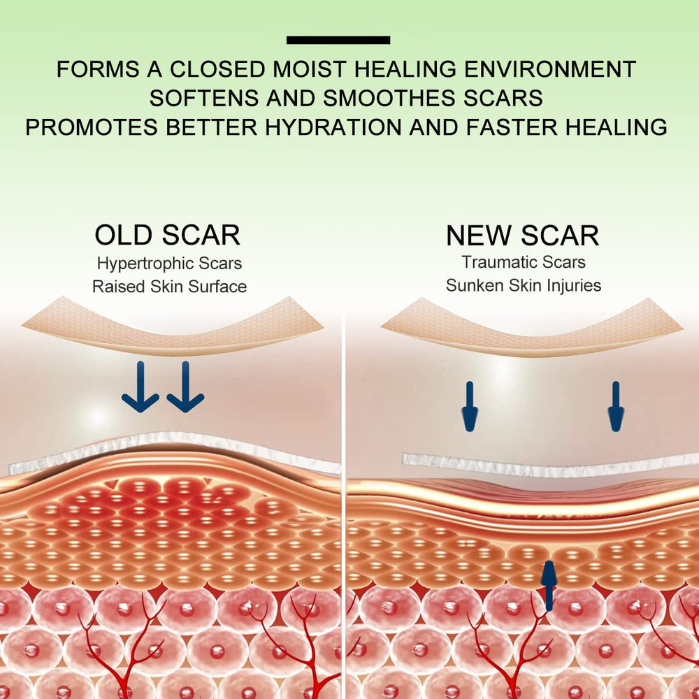 ZODENIS scar tape over acne scar for smoother healing.