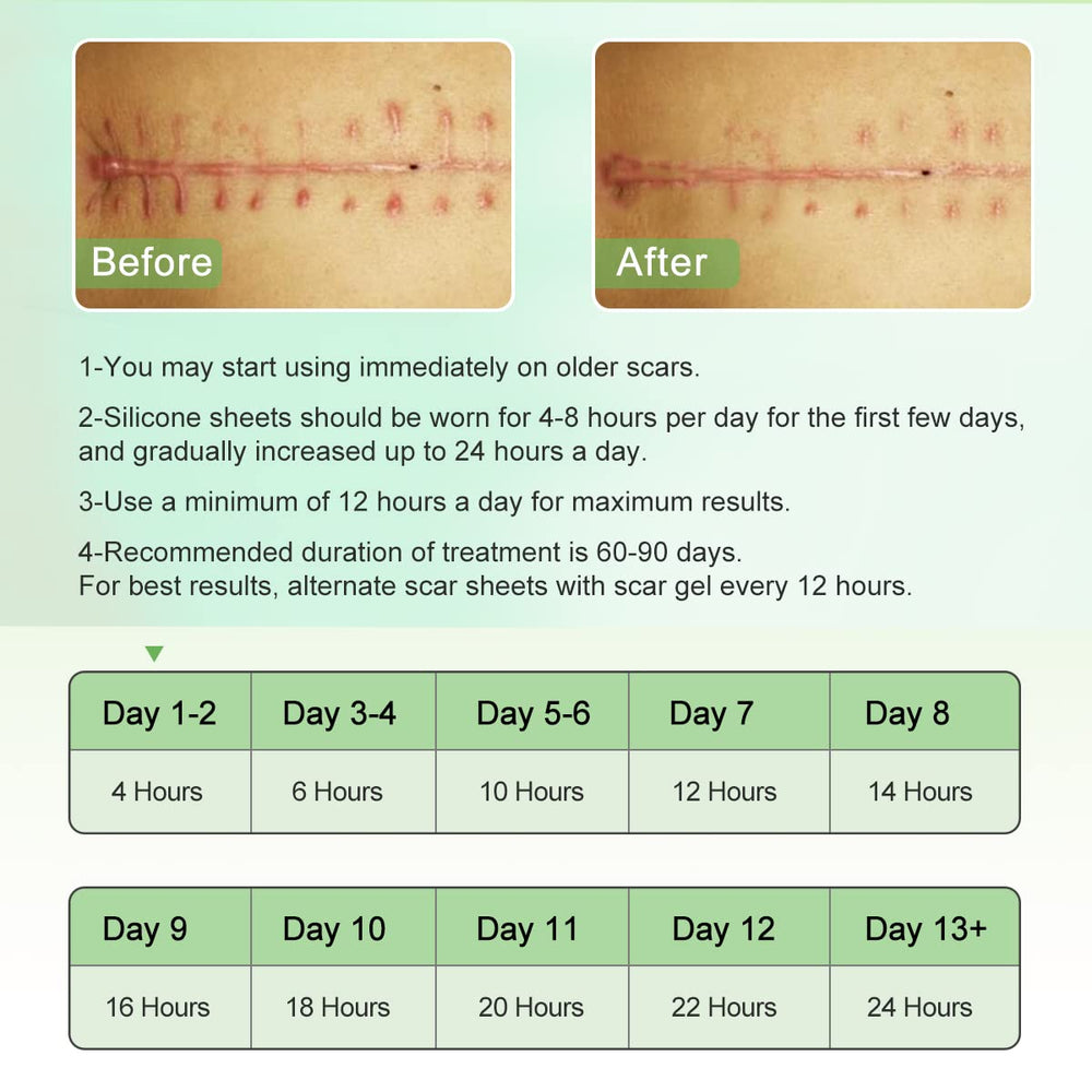 ZODENIS scar tape removal shown as painless and easy.