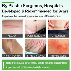 ZODENIS scar tape worn on skin, soft and flexible for daily wear.