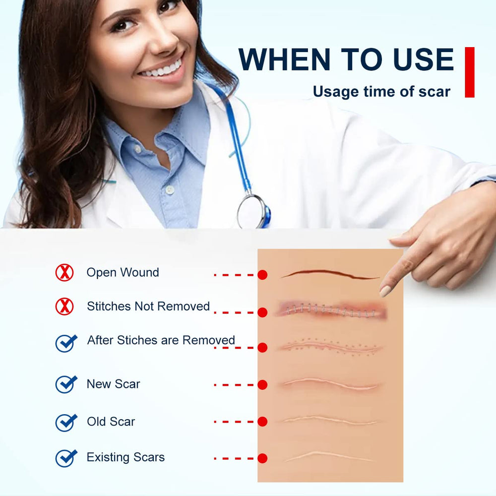 ZODENIS silicone scar sheets over a C-section scar to soothe irritation.